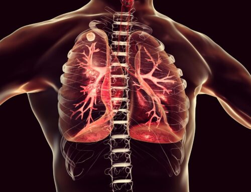 Chronic Obstructive Pulmonary Disease COPD